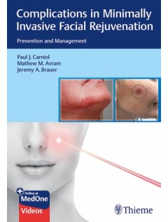 Complications in Minimally Invasive Facial Rejuvenation